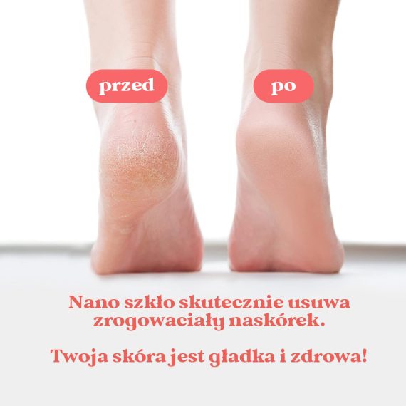 Skini - Nanokryształ Do Stóp