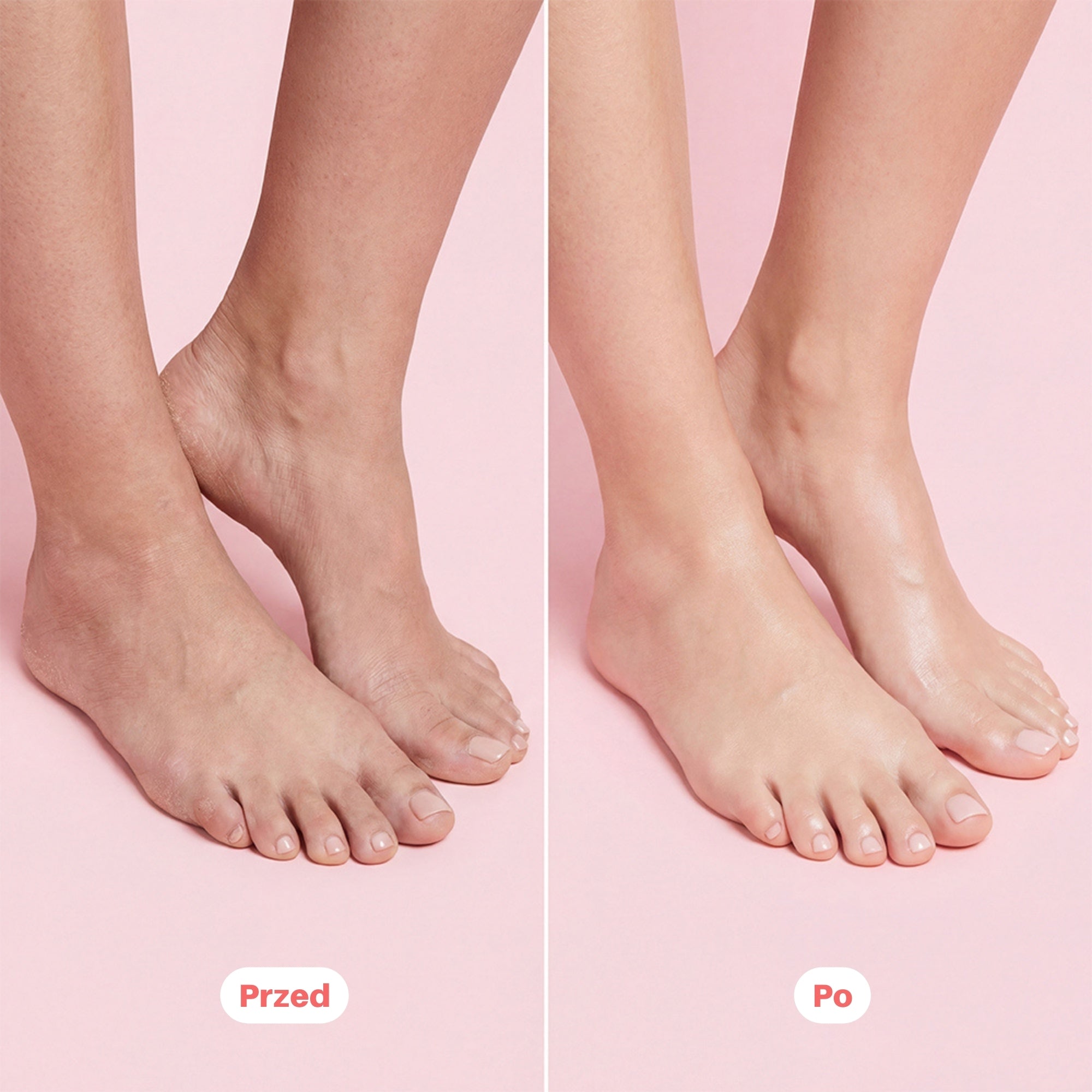 Skini – Regenerujące Skarpety Silikonowe